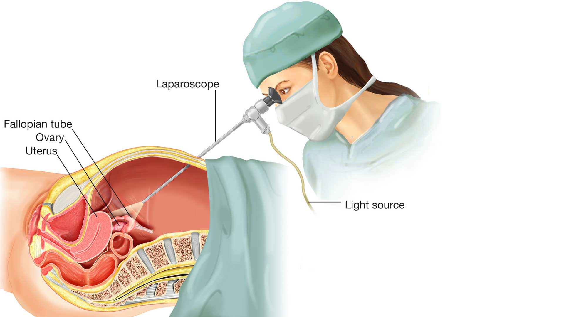 Laparoscopic Surgery In India