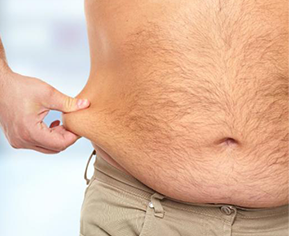 Liposuction